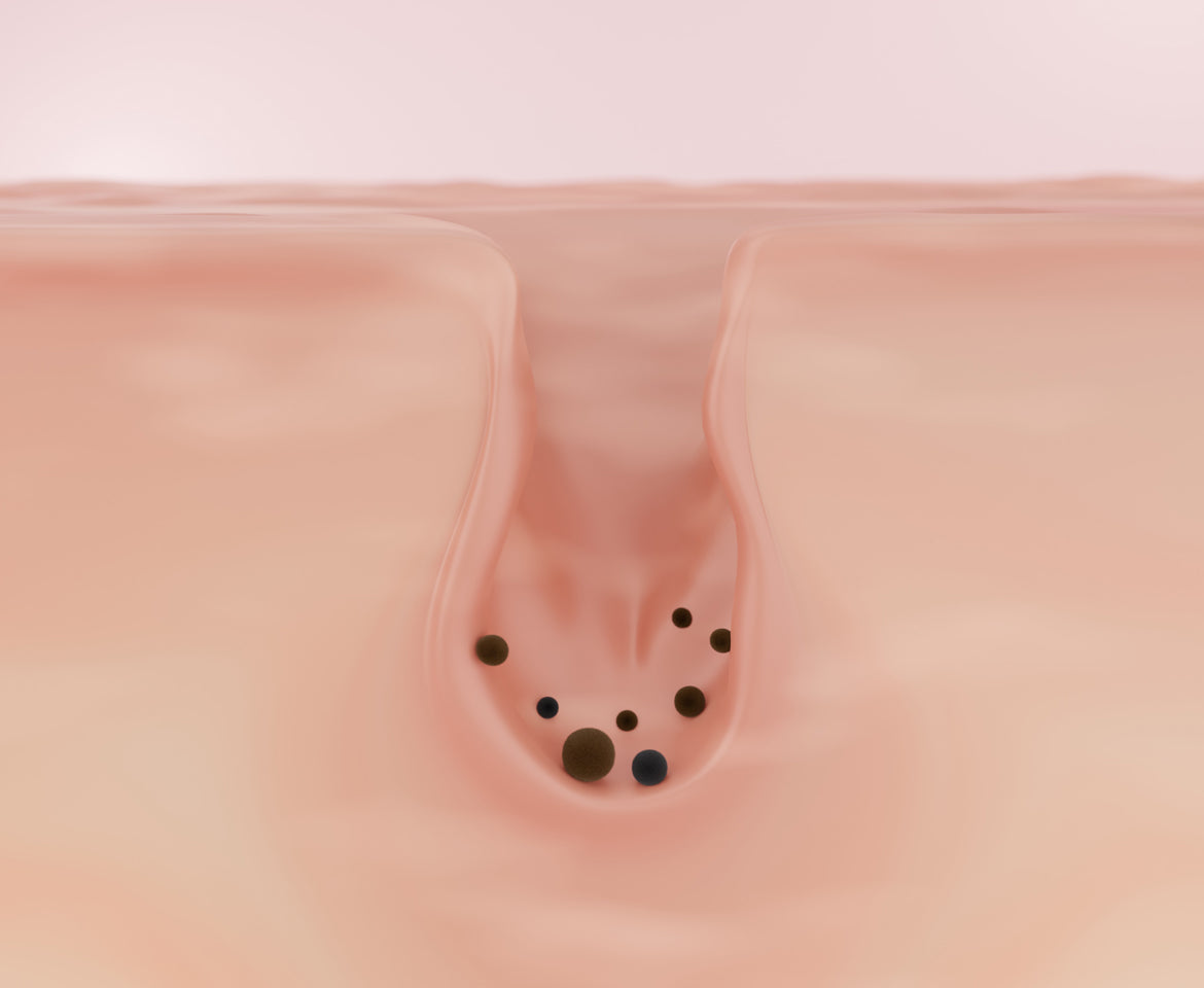 Pollutants causing pigmentation or dark spots