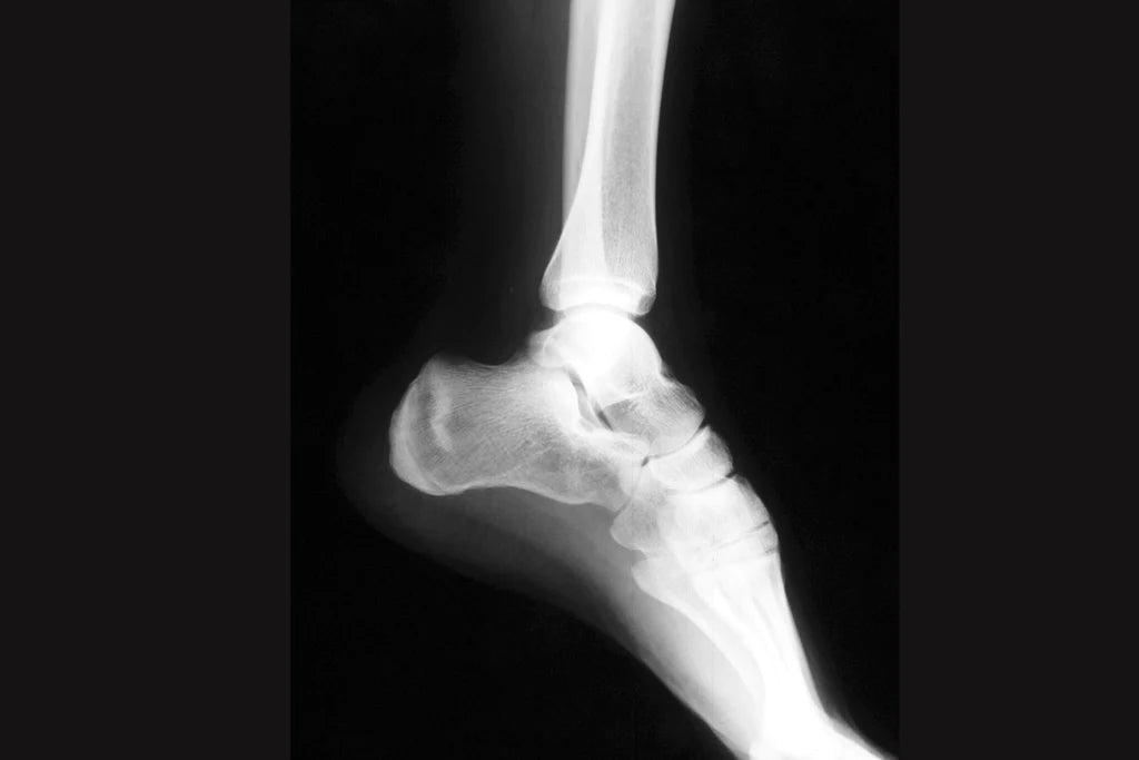How do doctors diagnose ankle pain when walking?
