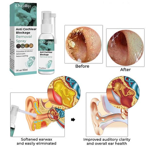 Oveallgo™ Anti Cochlear Blockage Removal Spray 