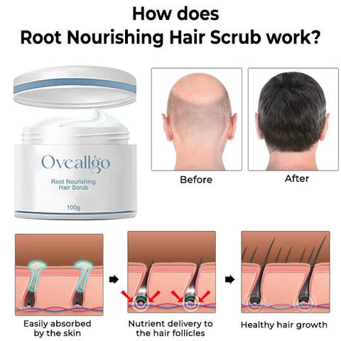 Oveallgo™ Root Nourishing Hair Scrub
