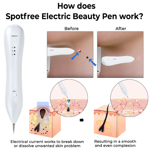 Oveallgo™ Spotfree Electric Beauty Pen