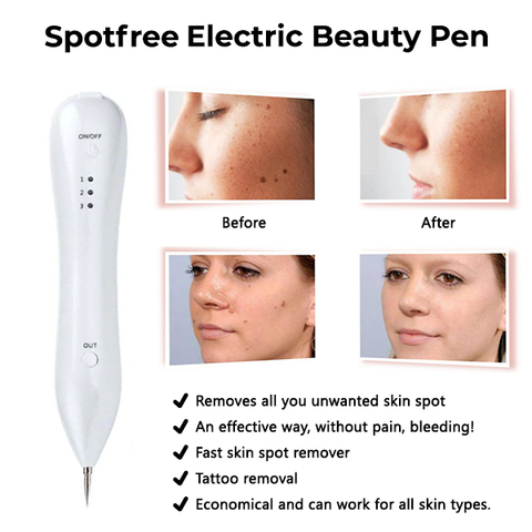 Oveallgo™ Spotfree Electric Beauty Pen