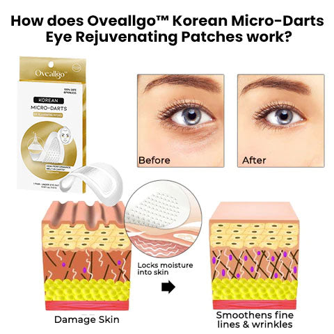 CNDB Korean Micro-Darts Eye Rejuvenating Patches