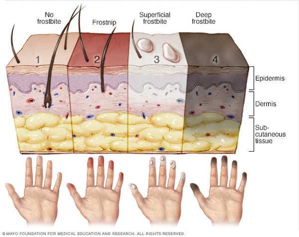 imagen de mayoclinic