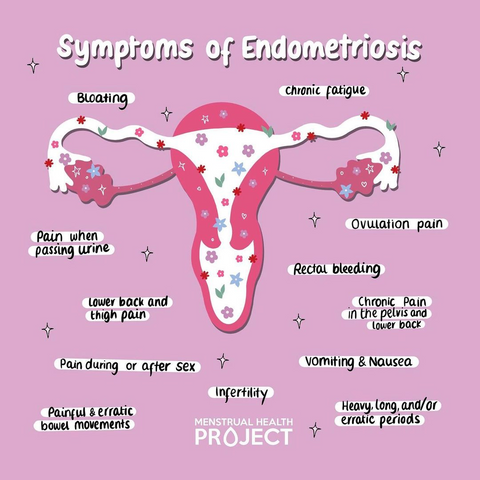 Endometriosis symtoms 