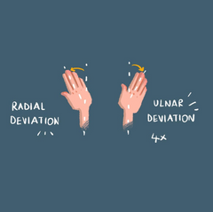 radial deviation ulnar deviation carpal tunnel syndrome