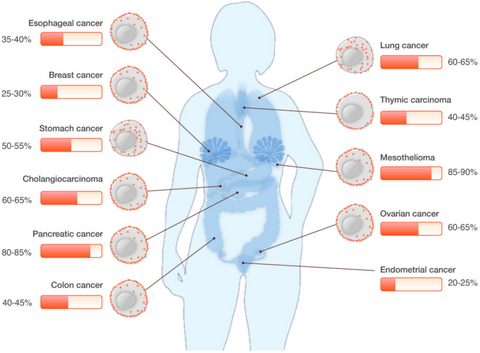 Expression of MSLN in different cancers