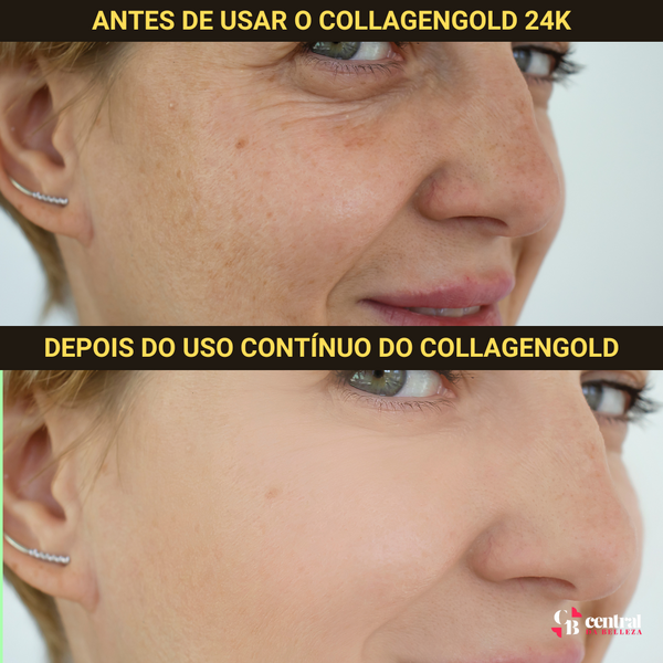 CollagenGold Central da Belleza