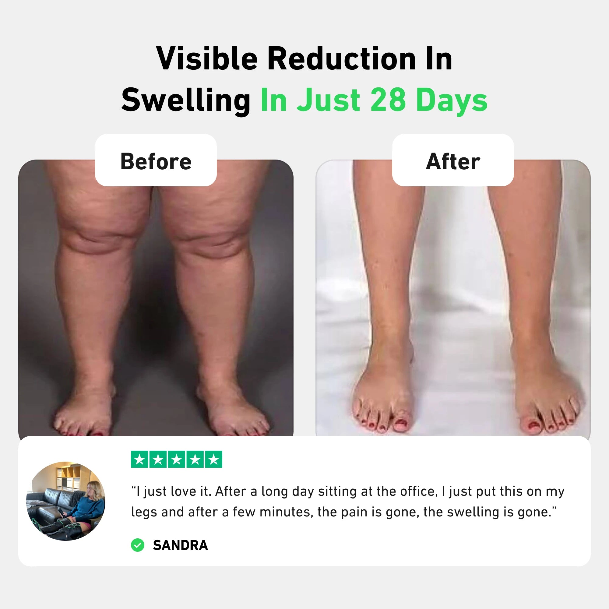 Before and after photos showing reduced swelling in legs over 28 days. Testimonial included.