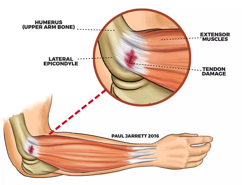 anatomy golfers elbow