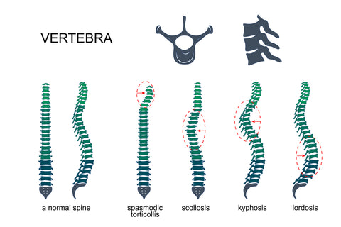 spinal alignment