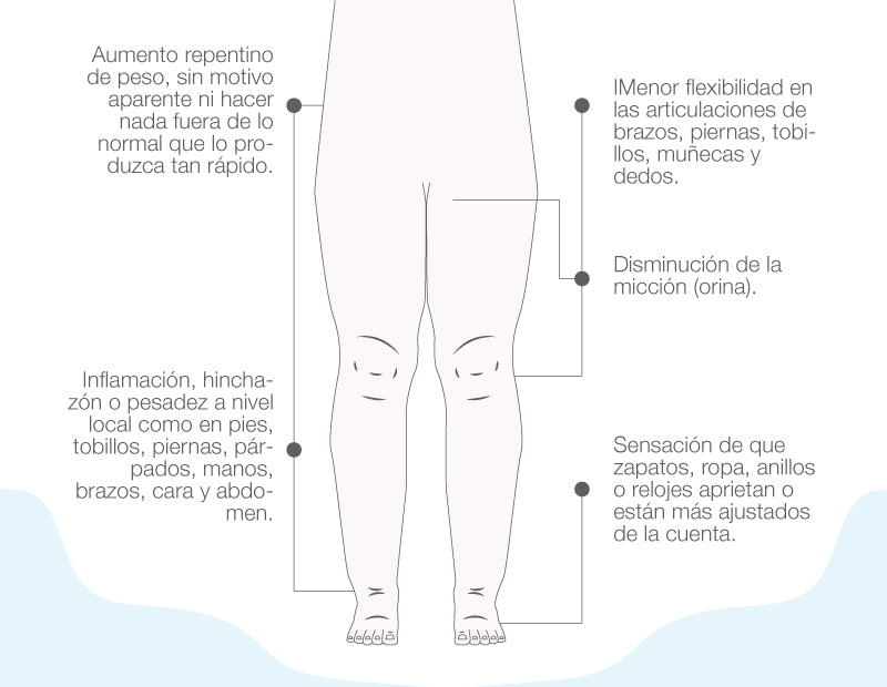 ¿Cuáles son los síntomas de la retención de líquidos?