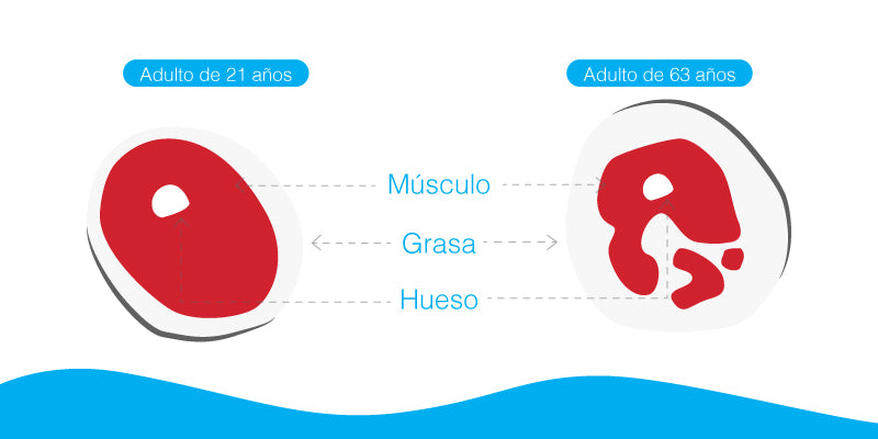 ¿Qué es la sarcopenia?