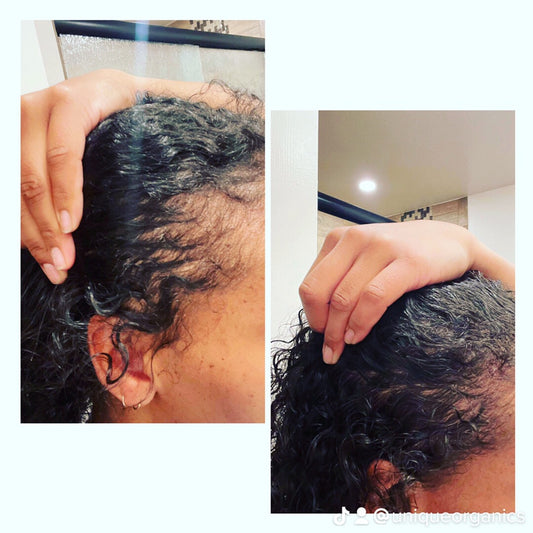 Neelibringadi Keram for Premature Greying  Hair Growth