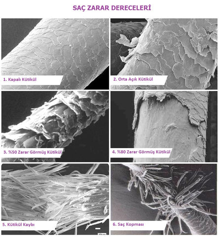 Saç zarar dereceleri