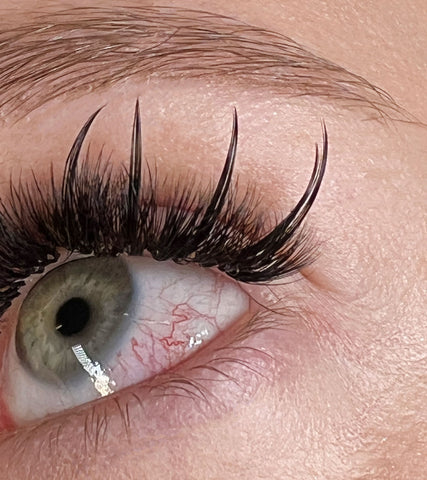 a close up of an eye with chemical burn