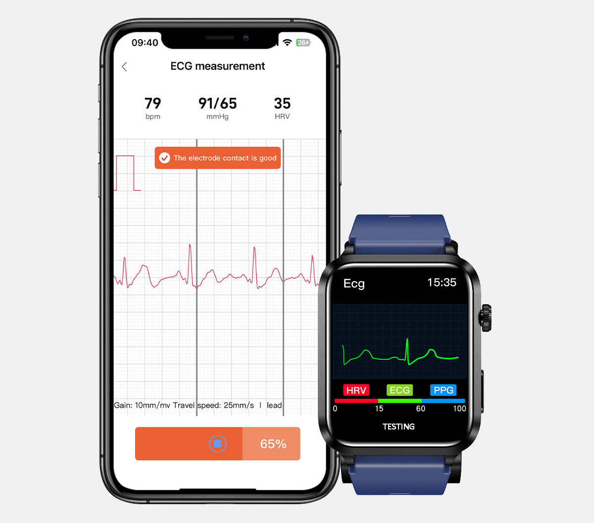 ECG monitoring