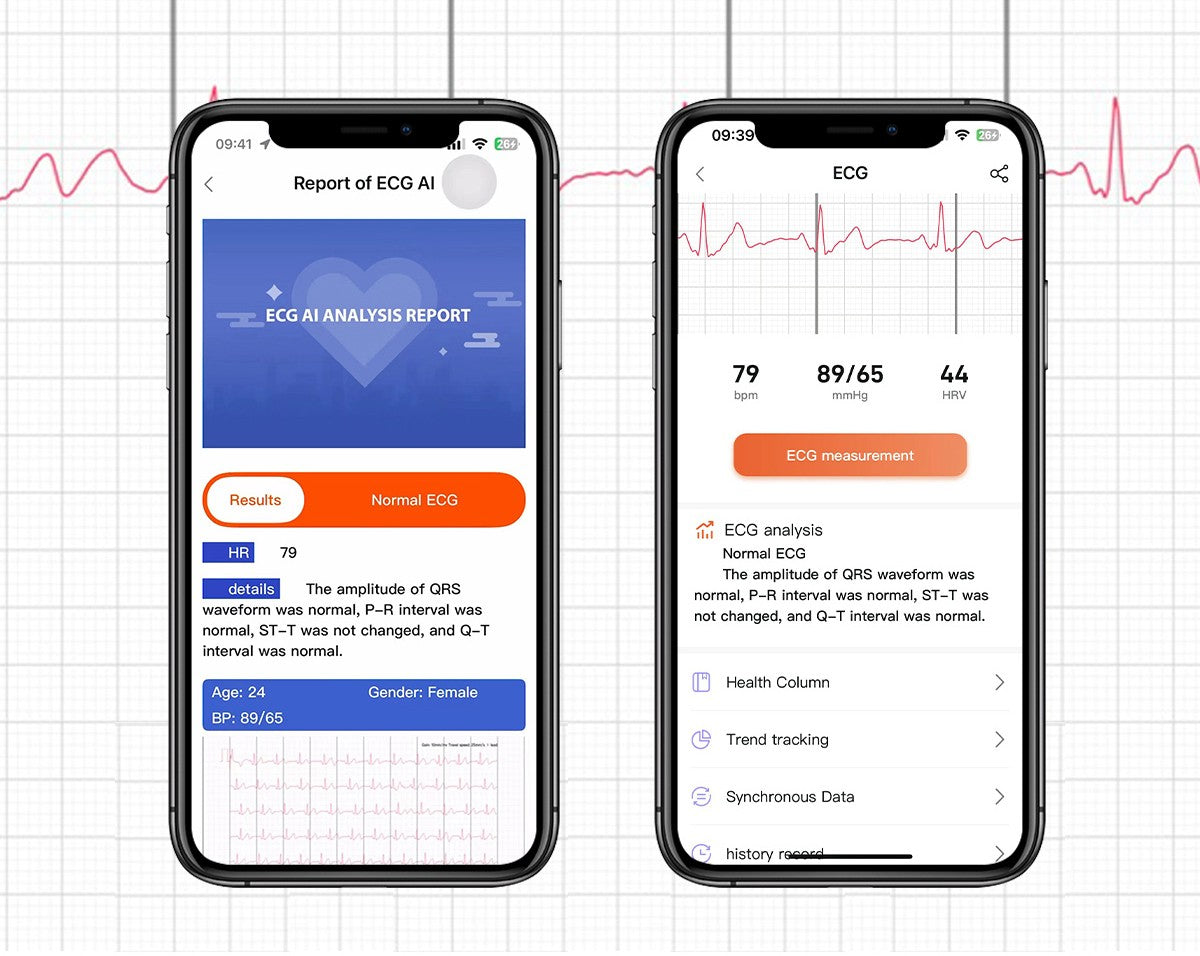 bp doctor ecg