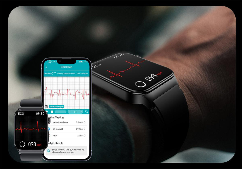 heart monitoring watch