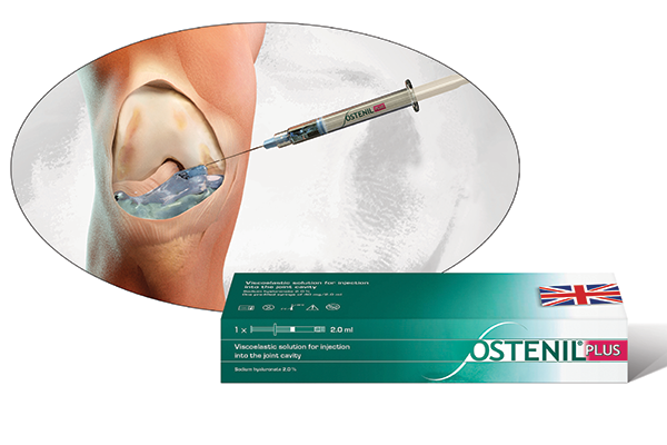 Ostenil Plus Injection into Knee Joint