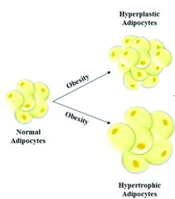 Hypertrophy Adipocytes