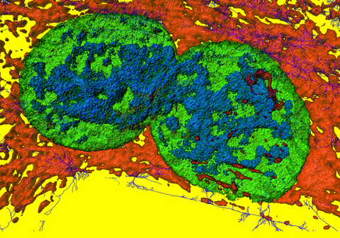 Dividing fibroblast c