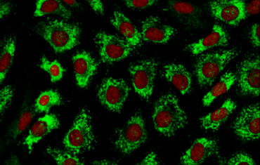 Fibroblasts treated with NIR