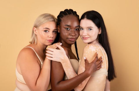 skin types