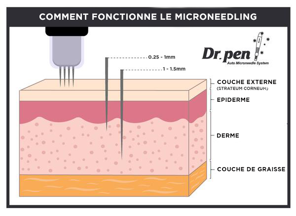 FR_Microneedling_Works