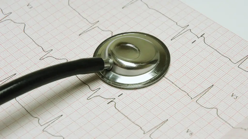 Stethoscope chest piece resting on an electrocardiogram printout, representing cardiovascular health monitoring when considering TMG supplements’ benefits, dosage, and side effects.
