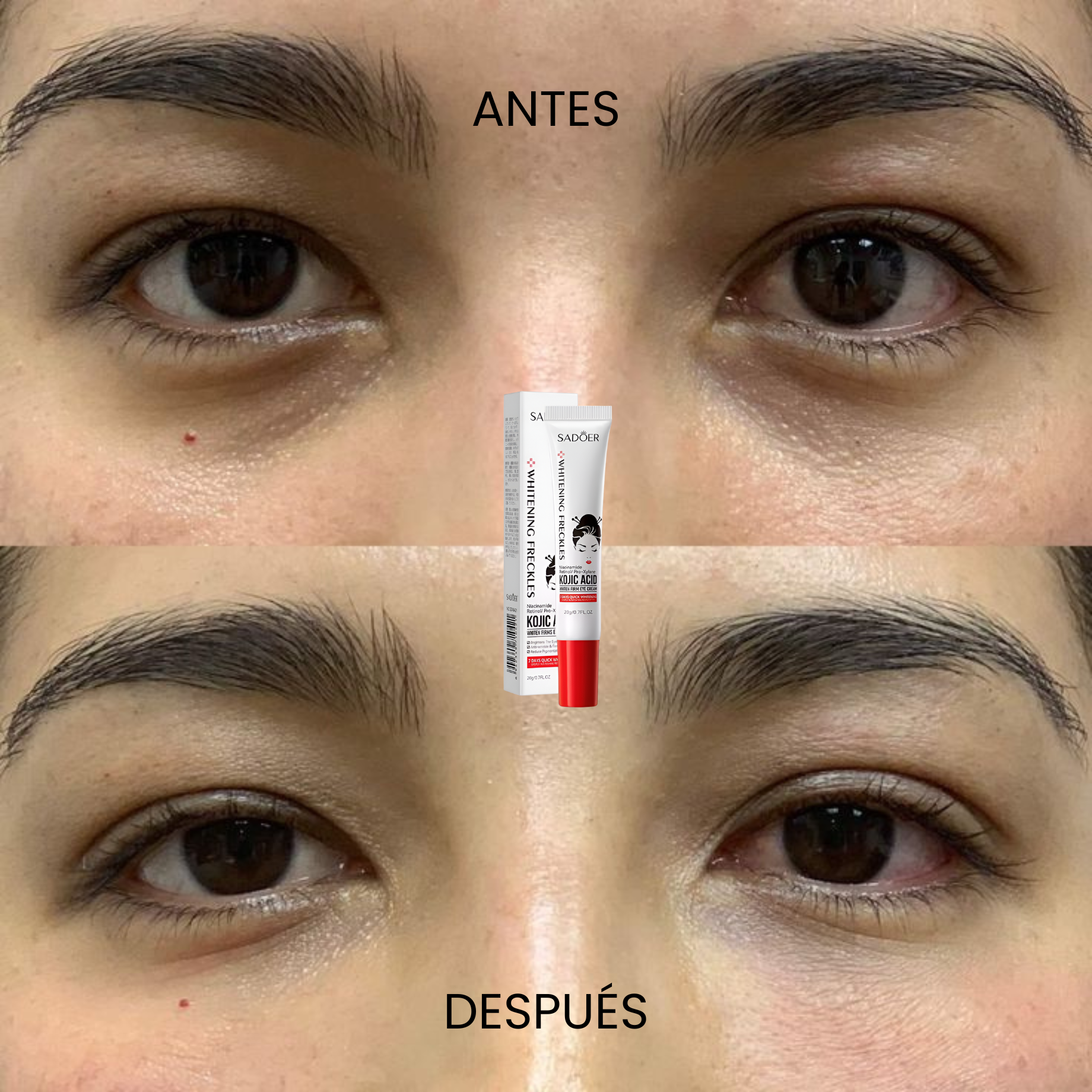 Antes y después contorno de ojos iluminador SADOER