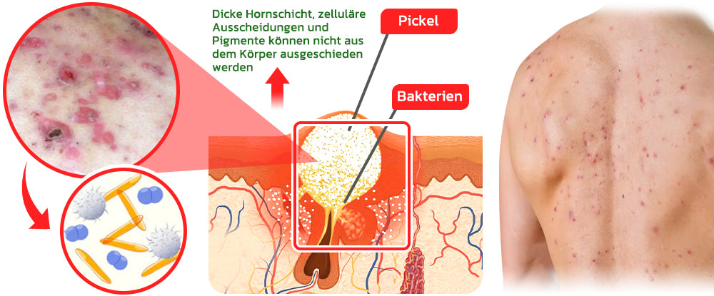 GFOUK™ BodyTreat Kollagen-Peeling-Essenz