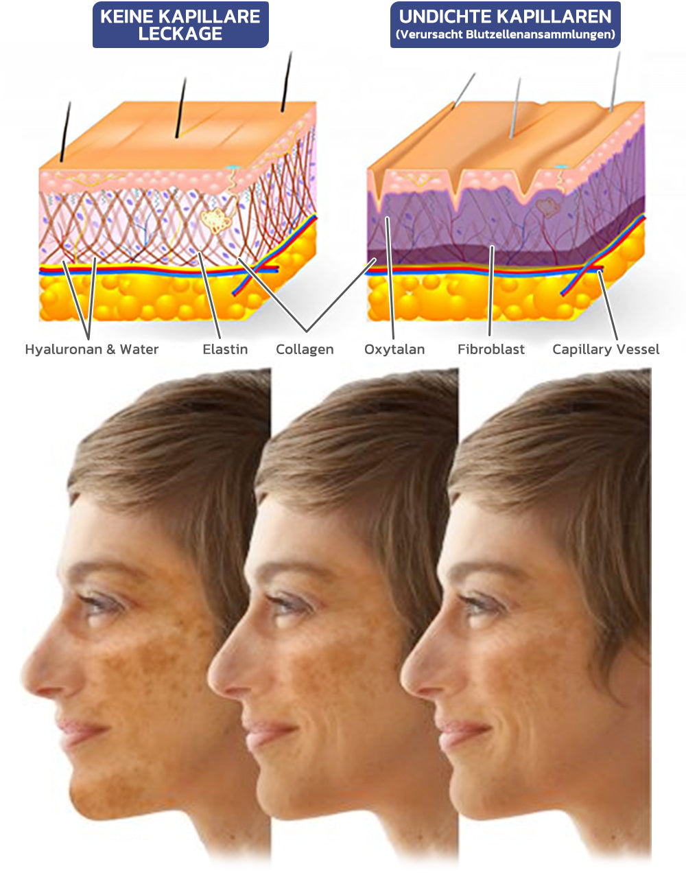 flysmus™ RENEWEYES Pigmentierte korrigierende straffende Augencreme 