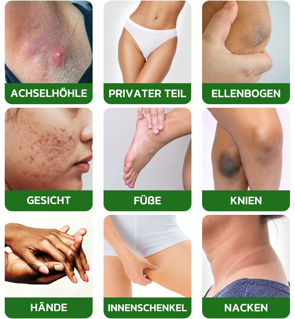 GFOUK™ BodyTreat Kollagen-Peeling-Essenz