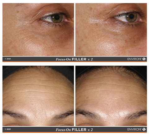 Before and after images of Environ Filler Creme
