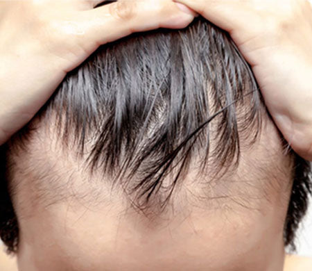 Ayurvedic Hair Pack for Hair Loss 