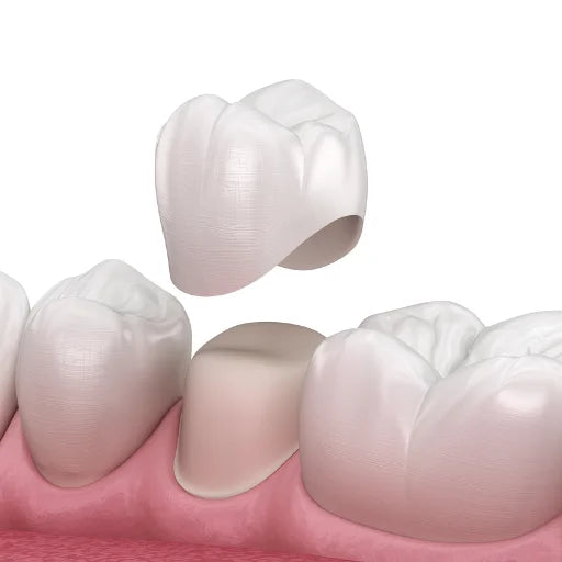 dental crowns