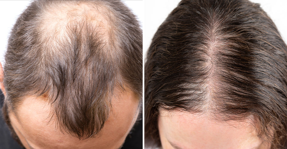 LED Light Hair Loss Therapy  Revive Clinic