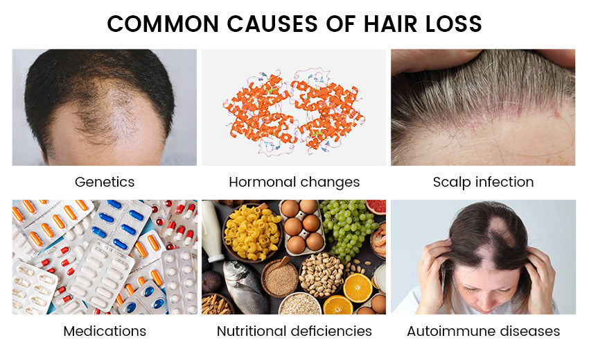 Illustration of 6 Major Hair Loss Causes
