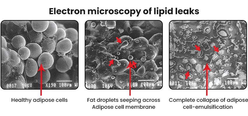 Electron microscopy of lipid leaks