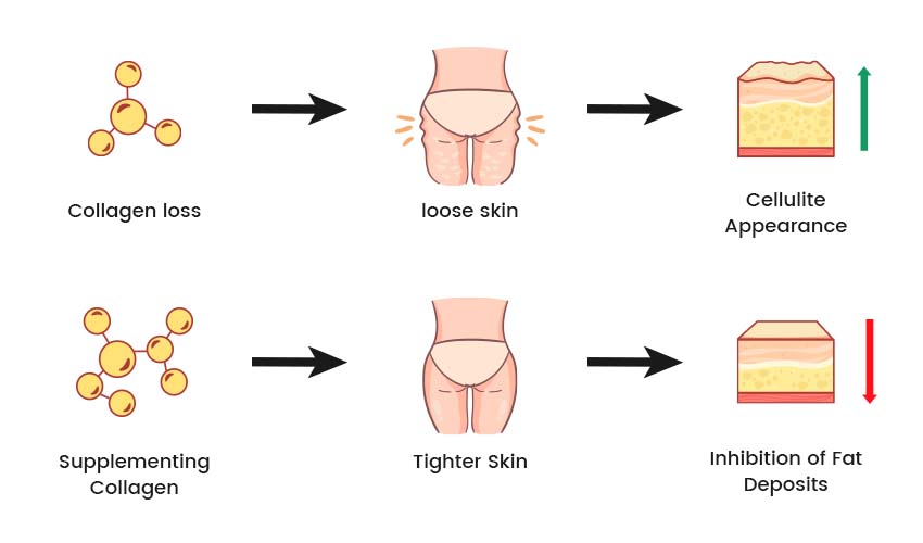 One image explains the relationship between collagen, loose skin, and cellulite.