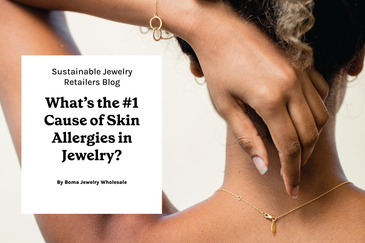Boma Jewelry Wholesale Blog Cause for Skin Irritations in Jewelry