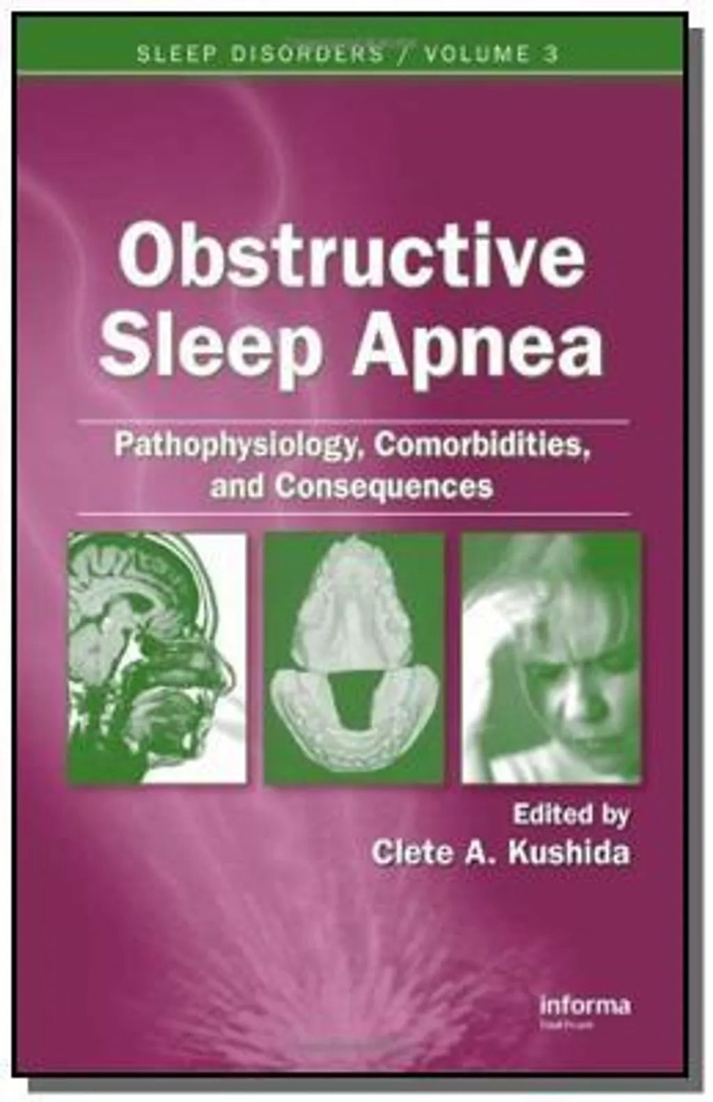 Obstructive Sleep Apnea Pathophysiology Comorbid Loja Skeelo