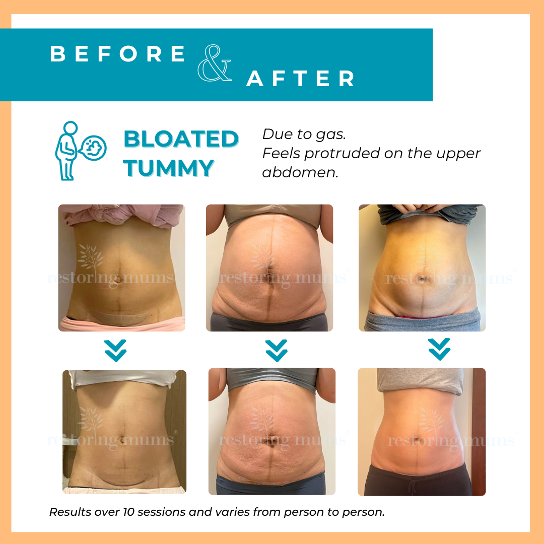 Restoring mums slimum Belly binding postnatal slimming wellness Bloated Tummy