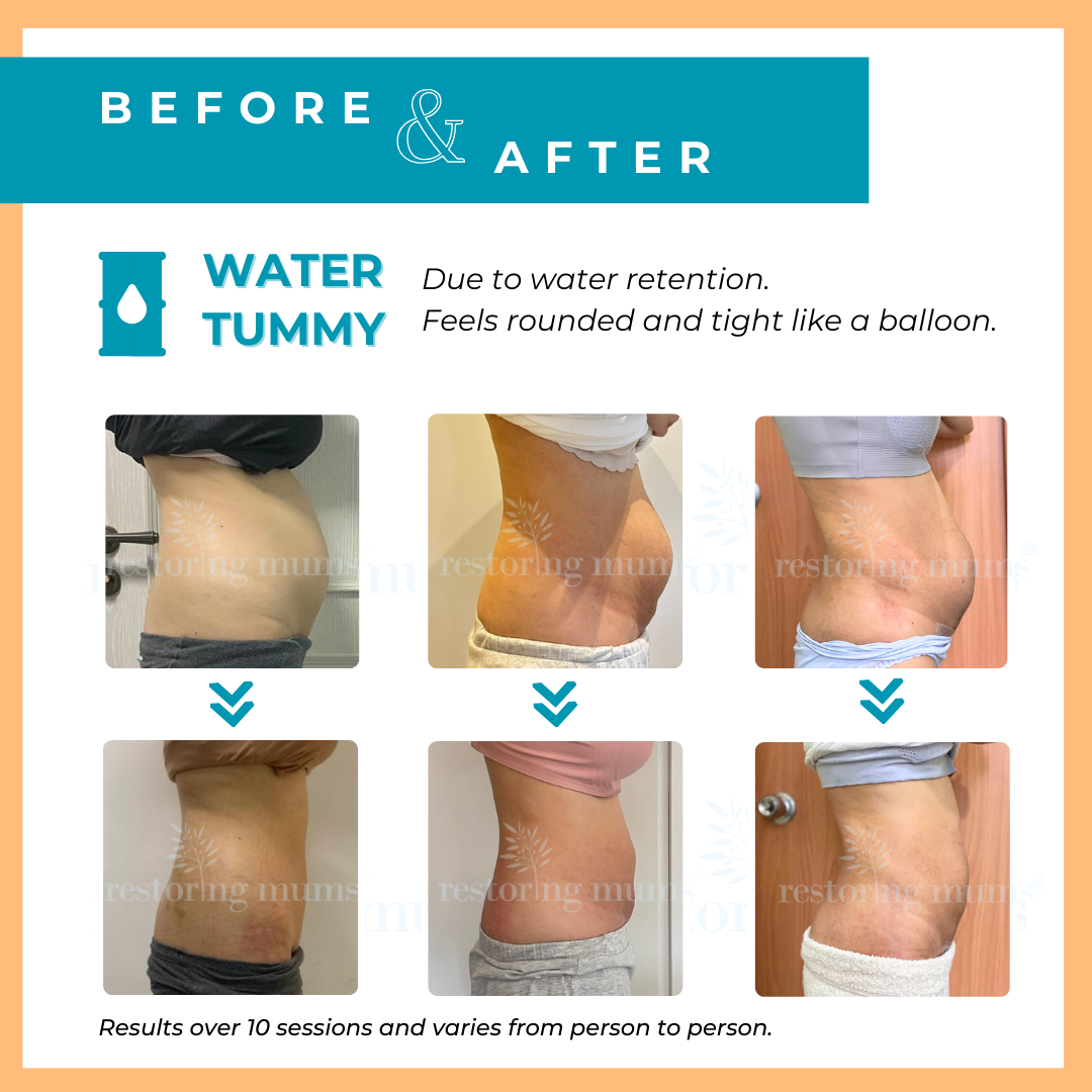 Restoring mums slimum Belly binding postnatal slimming wellness Water Tummy