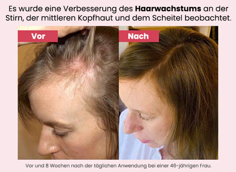 PURA Essenz Haar Wiedergeboren Biotin Shampoo 