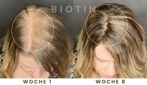 BIOTIN Haarwachstum PUMP-Serum