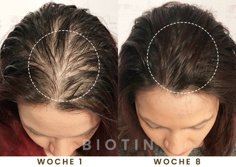 BIOTIN Haarwachstum PUMP-Serum