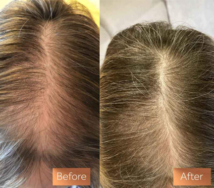 Maxine and Eva Hair Question and Answer – Absolute Collagen