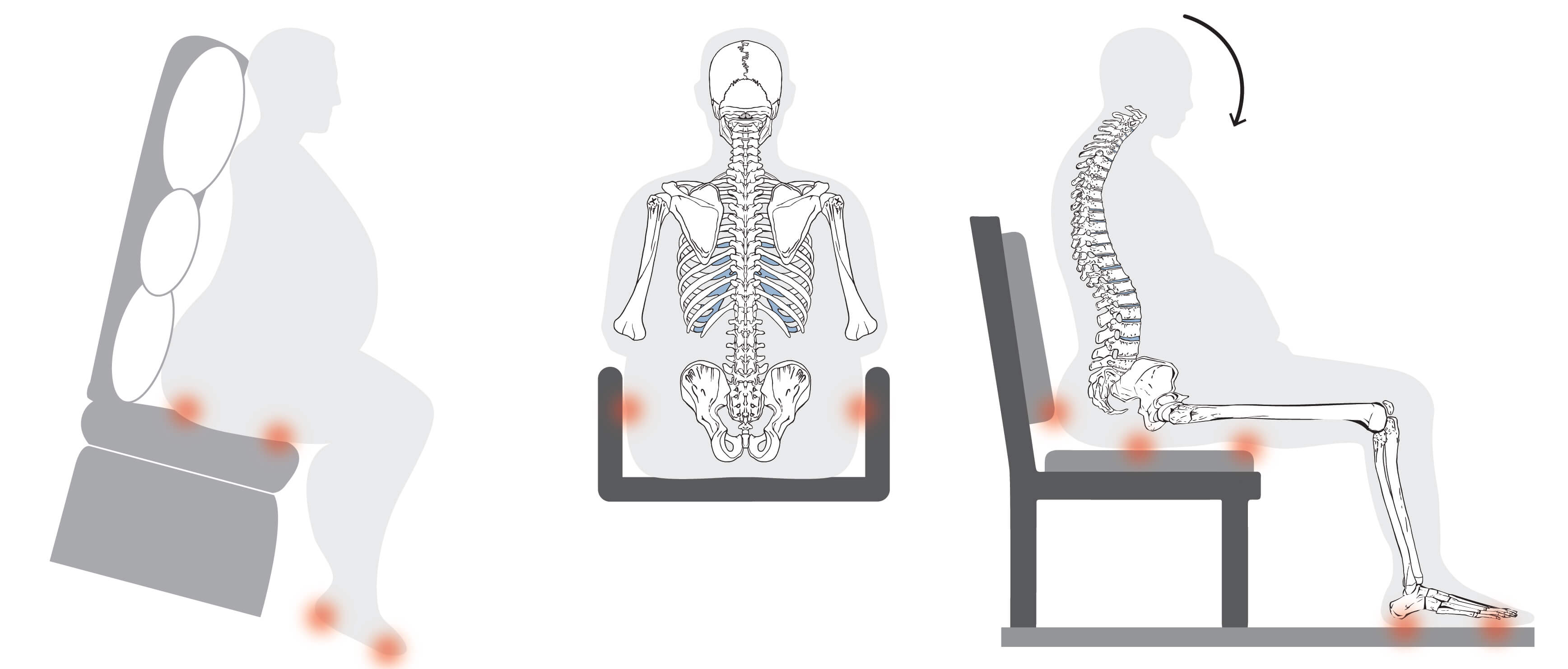 Clinical illustration comparing seated posture and pressure distribution in bariatric clients. Side and back views show skeletal alignment and key pressure points in incorrect seating scenarios—such as posterior pelvic tilt, sacral sitting, and poor contact with back support—versus optimal postural support with pressure redistribution across the thighs and trunk